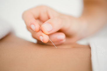 How Does Acupuncture Work